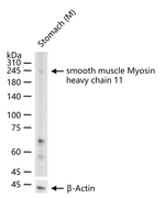 MYH11 Antibody in Western Blot (WB)