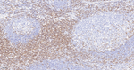 CD3 Antibody in Immunohistochemistry (Paraffin) (IHC (P))