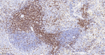 CD3 Antibody in Immunohistochemistry (Paraffin) (IHC (P))