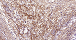 Periostin Recombinant Rabbit Monoclonal Antibody (2F7)