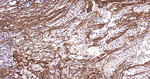 Periostin Antibody in Immunohistochemistry (Paraffin) (IHC (P))