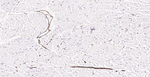 CD39 Antibody in Immunohistochemistry (Paraffin) (IHC (P))