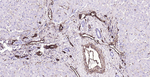 CD39 Antibody in Immunohistochemistry (Paraffin) (IHC (P))