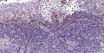 CD39 Antibody in Immunohistochemistry (Paraffin) (IHC (P))