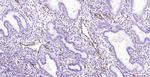 CD39 Antibody in Immunohistochemistry (Paraffin) (IHC (P))