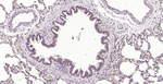 CD39 Recombinant Rabbit Monoclonal Antibody (3G4)