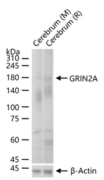 NMDAR2A Antibody in Western Blot (WB)
