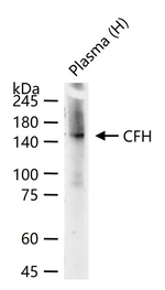 Complement Factor H Recombinant Rabbit Monoclonal Antibody (6F11)