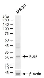 PGF Recombinant Rabbit Monoclonal Antibody (3F11)