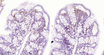 TGFBI Antibody in Immunohistochemistry (Paraffin) (IHC (P))