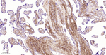 TGFBI Antibody in Immunohistochemistry (Paraffin) (IHC (P))