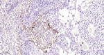 TGFBI Antibody in Immunohistochemistry (Paraffin) (IHC (P))
