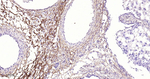 TGFBI Antibody in Immunohistochemistry (Paraffin) (IHC (P))