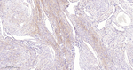 TGFBI Antibody in Immunohistochemistry (Paraffin) (IHC (P))