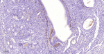 TGFBI Antibody in Immunohistochemistry (Paraffin) (IHC (P))