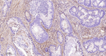 TGFBI Antibody in Immunohistochemistry (Paraffin) (IHC (P))