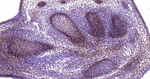 TGFBI Antibody in Immunohistochemistry (Paraffin) (IHC (P))