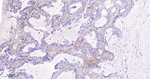 TGFBI Antibody in Immunohistochemistry (Paraffin) (IHC (P))