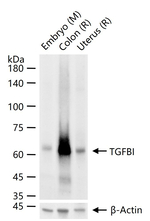TGFBI Antibody in Western Blot (WB)