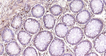 Ferritin Heavy Chain Antibody in Immunohistochemistry (Paraffin) (IHC (P))
