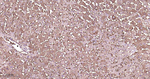 Ferritin Heavy Chain Antibody in Immunohistochemistry (Paraffin) (IHC (P))