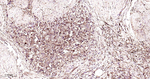 Ferritin Heavy Chain Recombinant Rabbit Monoclonal Antibody (5B5)