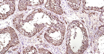 Ferritin Heavy Chain Antibody in Immunohistochemistry (Paraffin) (IHC (P))