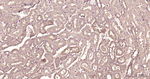 TXNIP Antibody in Immunohistochemistry (Paraffin) (IHC (P))