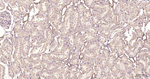 TXNIP Antibody in Immunohistochemistry (Paraffin) (IHC (P))
