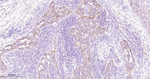 JAK1 Antibody in Immunohistochemistry (Paraffin) (IHC (P))