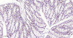 JAK1 Antibody in Immunohistochemistry (Paraffin) (IHC (P))