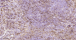 JAK1 Antibody in Immunohistochemistry (Paraffin) (IHC (P))