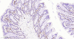 JAK1 Antibody in Immunohistochemistry (Paraffin) (IHC (P))