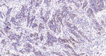 JAK1 Antibody in Immunohistochemistry (Paraffin) (IHC (P))
