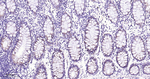 JAK1 Antibody in Immunohistochemistry (Paraffin) (IHC (P))
