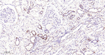 JAK1 Antibody in Immunohistochemistry (Paraffin) (IHC (P))