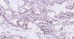 JAK1 Recombinant Rabbit Monoclonal Antibody (2B12)
