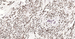 TFF1 Antibody in Immunohistochemistry (Paraffin) (IHC (P))