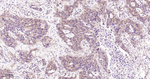 TFF1 Antibody in Immunohistochemistry (Paraffin) (IHC (P))