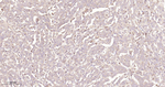 TFF1 Antibody in Immunohistochemistry (Paraffin) (IHC (P))