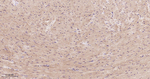 GCLM Antibody in Immunohistochemistry (Paraffin) (IHC (P))