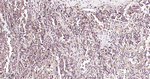 GCLM Antibody in Immunohistochemistry (Paraffin) (IHC (P))