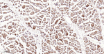 GCLM Antibody in Immunohistochemistry (Paraffin) (IHC (P))
