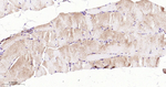 GCLM Recombinant Rabbit Monoclonal Antibody (4G5)