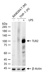 TLR2 Antibody in Western Blot (WB)