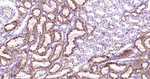 MMP3 Antibody in Immunohistochemistry (Paraffin) (IHC (P))