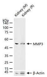 MMP3 Antibody in Western Blot (WB)