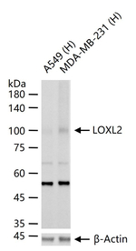 LOXL2 Recombinant Rabbit Monoclonal Antibody (7D7)
