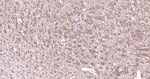 alpha Internexin Antibody in Immunohistochemistry (Paraffin) (IHC (P))