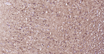 alpha Internexin Antibody in Immunohistochemistry (Paraffin) (IHC (P))